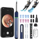 Bebird Note 5 Ear Camera Wax Removal, Tool Tweezer.... Fixed Price $85.08.